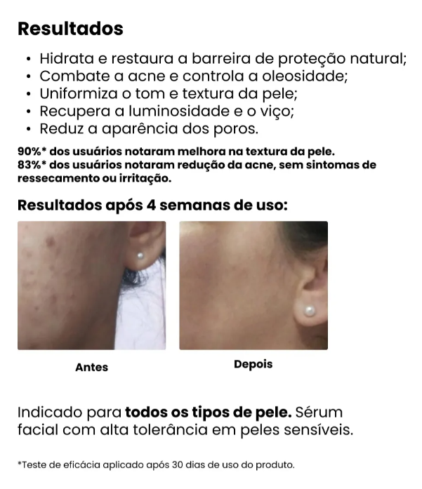 Creamy  Ácido Lático Antiacne e Sebo reguladora 30g