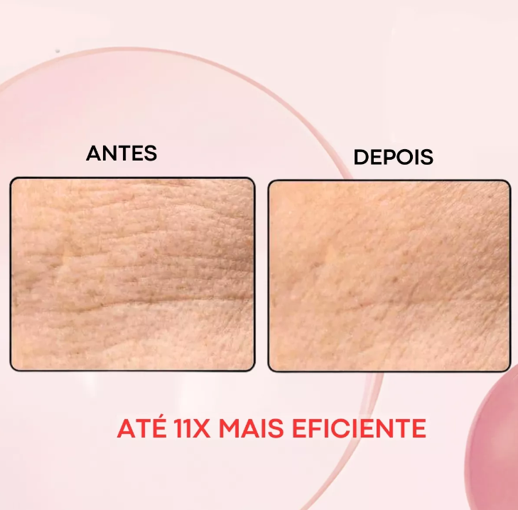 Creamy Sérum Facial Retinal  Noturno Anti Aging 30g
