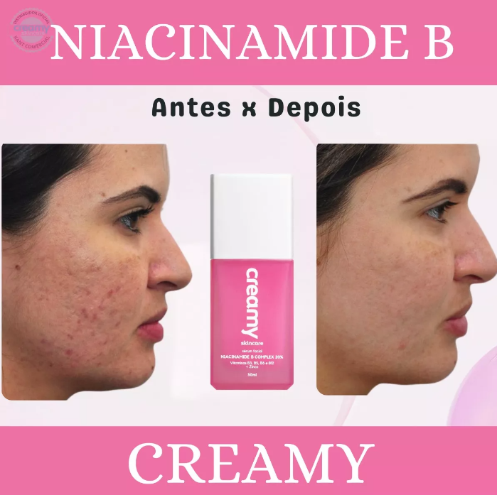 Creamy Niacinamide B Complex 20%